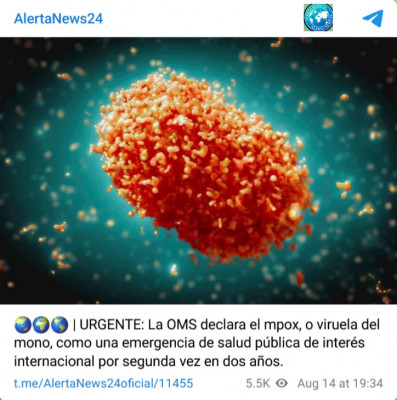 Viruela_del_mono_1.jpg
