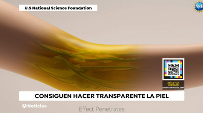 Piel_transparente_1.jpg